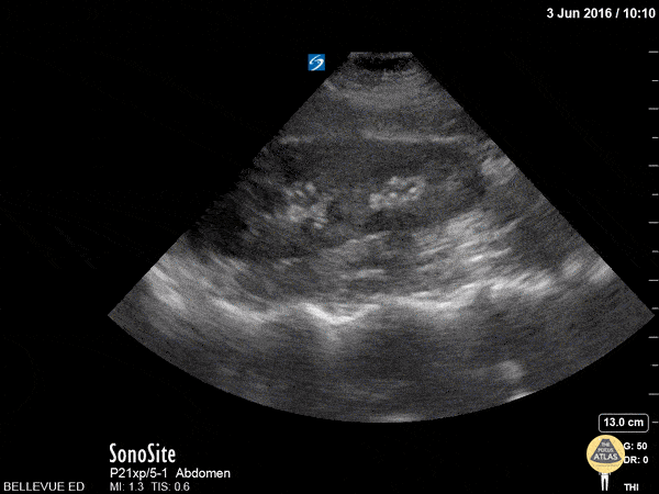 Atlas of Renal Ultrasonography 希少 腎臓 | gulatilaw.com